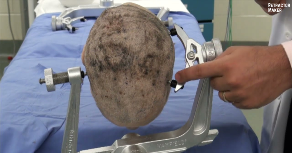 MAYFIELD Skull Clamp During Surgery