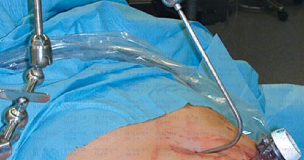 What is the Nathanson Retractor? Assembly and Uses
