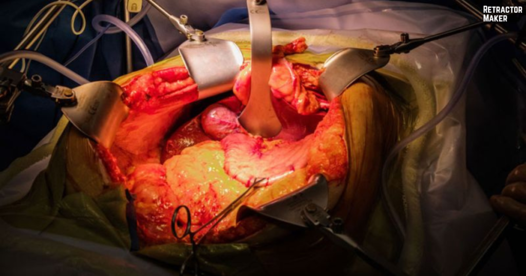 Thompson Retractor During Surgery