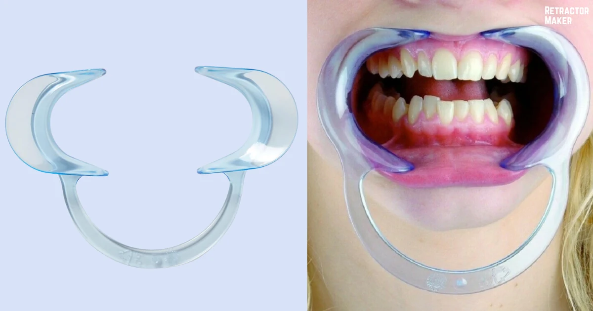 Plastic cheek retractor positioned for oral surgical exposure.