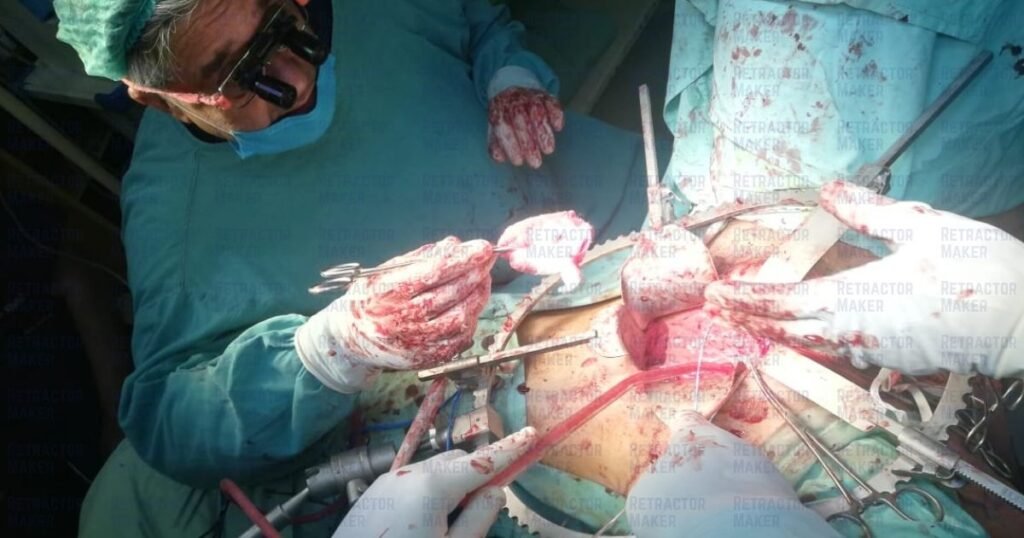 Common Uses of the Bookwalter Retractor